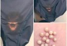 BE VERY CAREFUL 🚨. If you get this, you are infected with …. See more