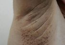 These are the first symptoms of cr…See more