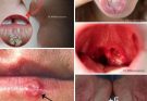 These are the signs that he is cr… See more