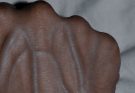  If your veins are visible in your hand, it is a signal of ca… See more