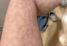These are the consequences of sleeping with the… See more