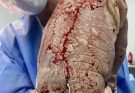 Baby born with an DIU peg… See more