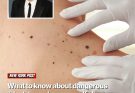 Kelly Clarkson’s ex-husband Brandon Blackstock dies at 48 . What to know about dangerous ‘black tumor’ cancer as