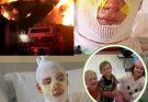 Brave Briton Runs Into Fire—The Untold Truth Behind a Heart-Stopping Rescue That Will Bring You to Tears! Derrick Byrd, 20, was awakened by a deafening explosion and his sister’s screams—the fire was consuming their home. Without hesitation, he ran through the smoke and flames to save his family. He caught Junior, six, and Rory, three, as they jumped from an upper-story window. Then Mercedes, eight, was trapped inside. Derrick ran back into the flames, covered her with his coat, and carried her to safety. Even after his family was