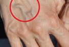 If you have visible veins, it means you are… See more