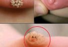 These are the first signs of an enf…See more