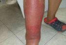 😱😱Signs on your FEET that indicate he is cr… see more