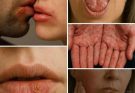😱😱Don’t Underestimate It: Recognizing the Early Signs of Oral Can…