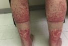 These are the consequences of sleeping with the…See more