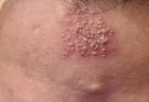 These are the consequences of sleeping with…See more