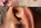 😱😱DID YOU KNOW that if hair grows on your ears, it’s because your body is…See more