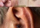 😎DID YOU KNOW that if hair grows on your ears, it’s because your body is…See more
