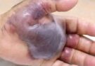 ATTENTION To These First Signs Of…See More