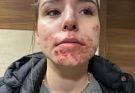 These are the consequences of sleeping with a… See more